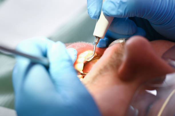 Best After-Hours Emergency Dentist in Bluffton, SC